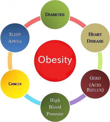 Essay about obesity cause and effects